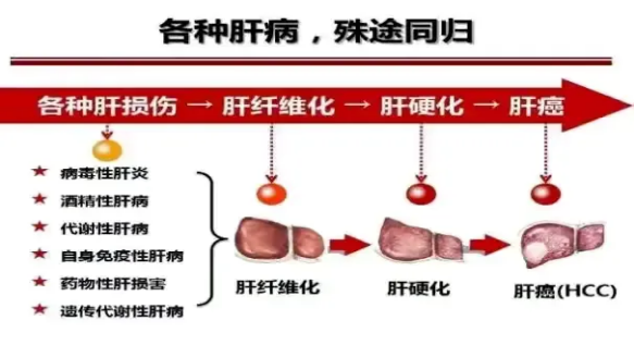 2024年世界肝炎日┃“肝”货知识