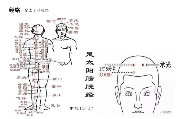 承光穴：主治头痛、目眩、癫痫